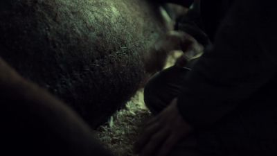 Who performed this c-section? - Hannibal