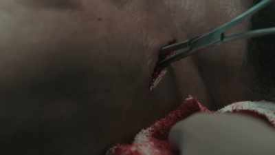 Whoa! Don't do that... - Coroner