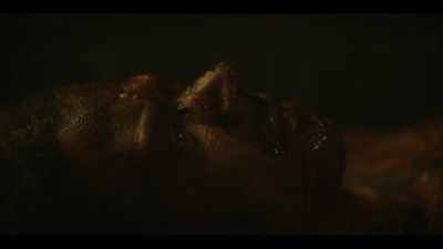 Why are you ill?
What's happened to you? - Interview with the Vampire