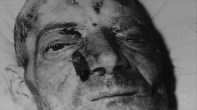 Within a few days
of beginning penicillin treatment, - Aussie Inventions That Changed The World