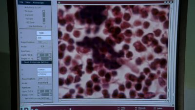 Wow, liver cells under his arm. - House