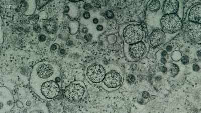 Yeah. So this is zooming in now
on an infected cell. - Secrets of Size: Atoms to Supergalaxies