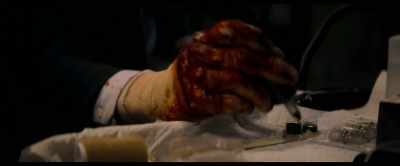 Yeah, um, yeah,
hold on one second. Um... - Novocaine