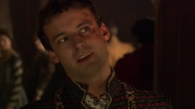 - You almost lost an eye.
- Never use that one much anyway.  - The Tudors