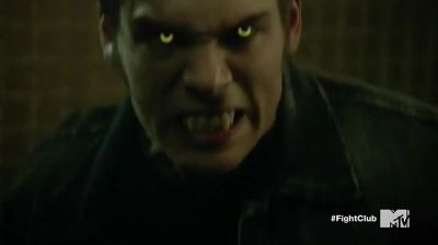 You angry? - Teen Wolf