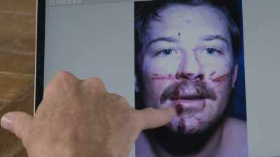 You can see where it came
into my chin, - Unabomber: In His Own Words