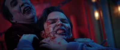 You can't take my teeth. - Renfield