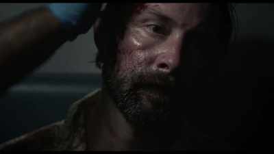 You got a pretty good cut
on your forehead here. - The Dead Center