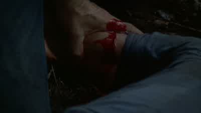 You hit an artery. - Lost