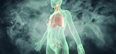 You know the big ones,
or in the lung, - Root Cause