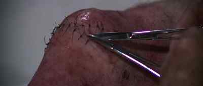 You may feel as the
stitches come out. - The Killer Elite