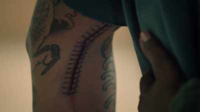 You see that elbow scar - High Potential