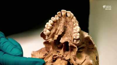 You see, there is a hole in the jaw. - Curse of the Ancients with Alice Roberts