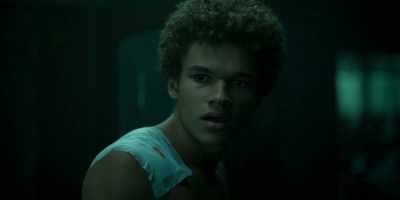 You used to have
acne scars, right? - Wolf Pack