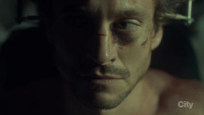 You'll be sure to let
me know if this hurts, - Hannibal