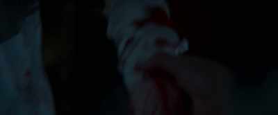 Your arm's bleeding.
Come here. - Boys from County Hell