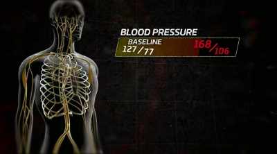 Your blood pressure's
a little elevated, 168/106. - Kings of Pain