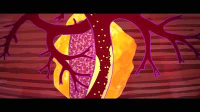 Your body can't turn 
those carbs into fat - What the Health