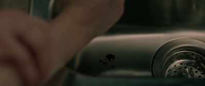 Your hand.
Can I take a look at that? - Sightless