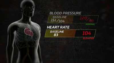 Your heart rate's up 104. - Kings of Pain