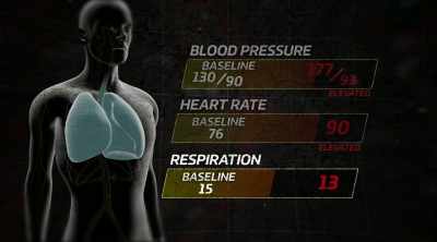 Your respiratory rate is 16,
which is right with normal. - Kings of Pain