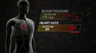 Your respiratory rate
in the 20s. - Kings of Pain