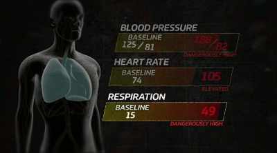 Your respiratory rate
is in the upper 40s, - Kings of Pain