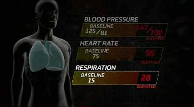 Your respiratory rate's
elevated in the upper 20s. - Kings of Pain