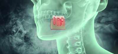 Your tooth is connected
to your jawbone - Root Cause