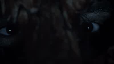 You're a werewolf! - Teen Wolf
