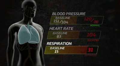 You're breathing at 29, 31, - Kings of Pain