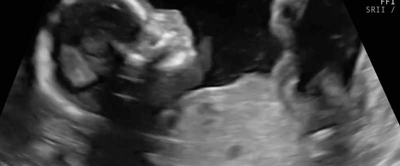 60% of all new births
