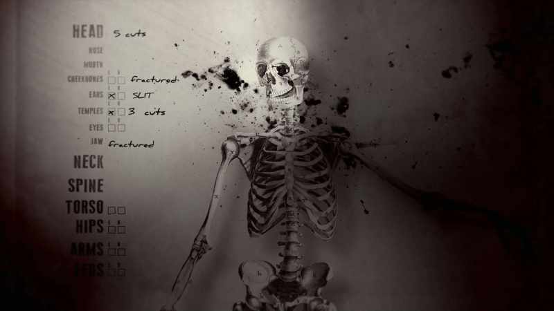 A dreadful gash in his neck scratched his windpipe