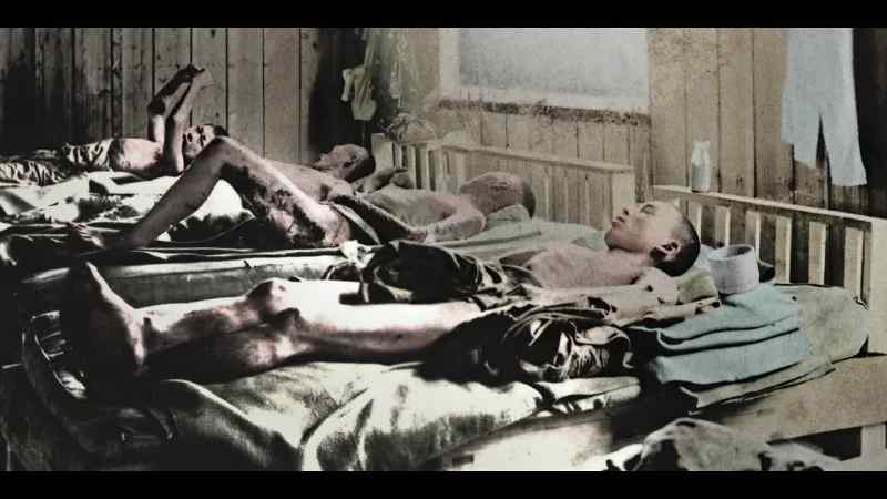 A hundred and 50 thousand more will die from radiation sickness