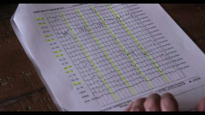 A normal EEG
