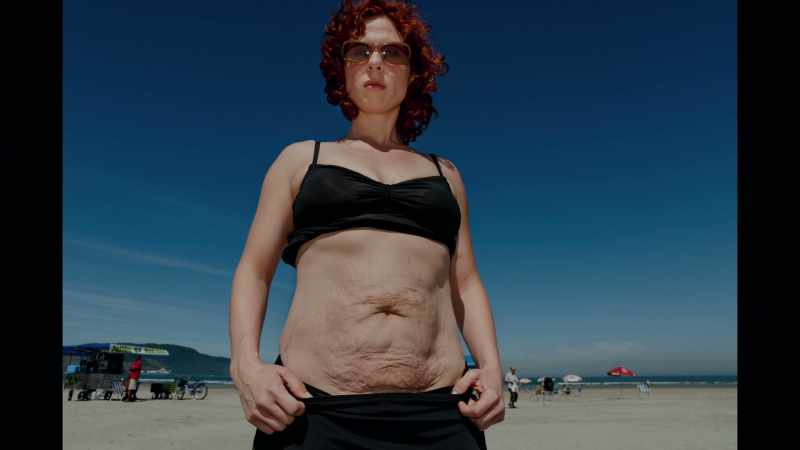A pregnancy that really had distorted my body