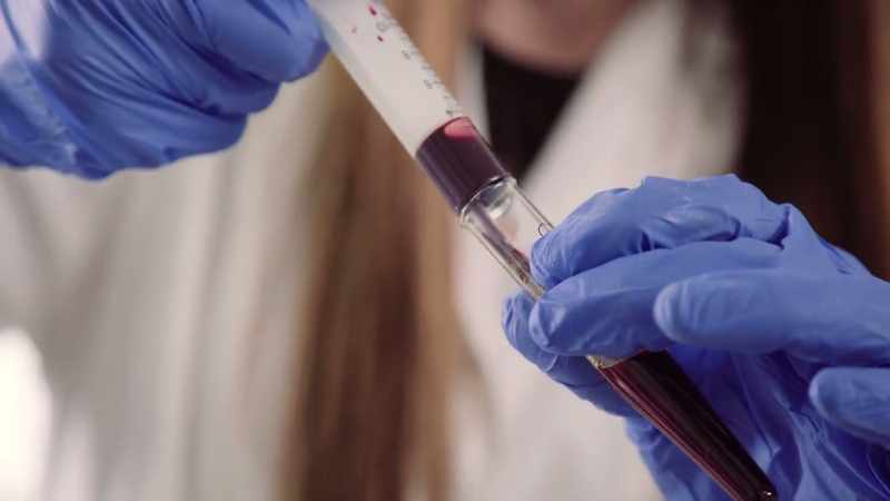 A virus like COVID-19 is ultimately more lethal