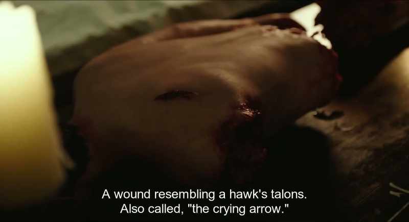 A wound resembling a hawk's talons. Also called, 