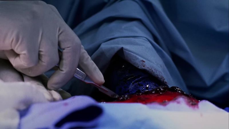 Addison,put the scalpel down