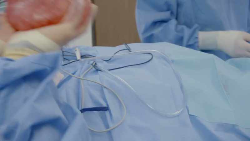 After their surgery, I can't explain exactly why