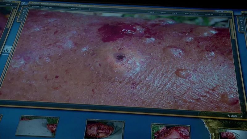 Ah, yes. This appears to be an injection site