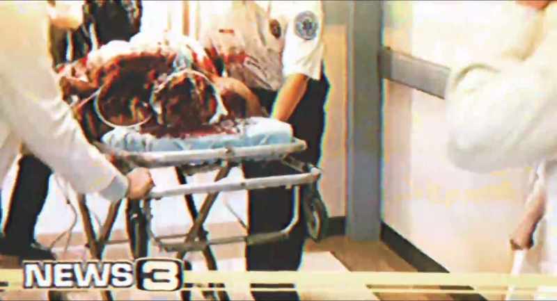All three suspects remain in intensive care