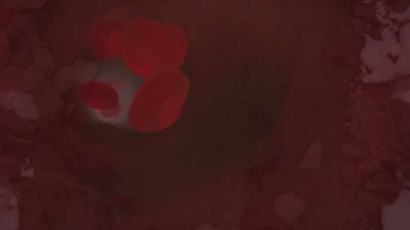 {\an1}And blood needs room to move