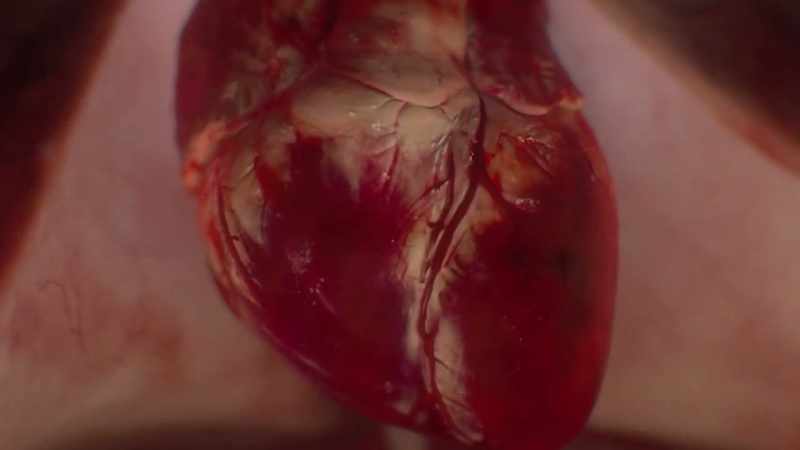 {\an1}-If there are neurons on the heart