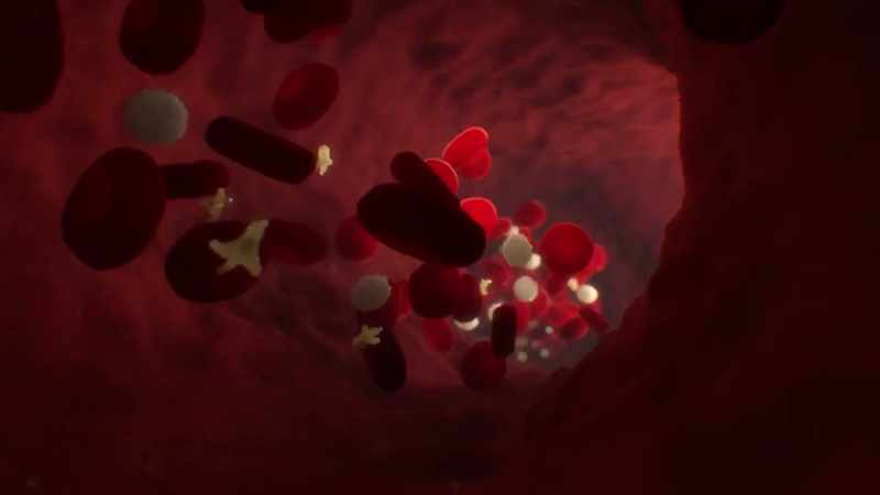 {\an1}It also helps reduce inflammation in blood vessels