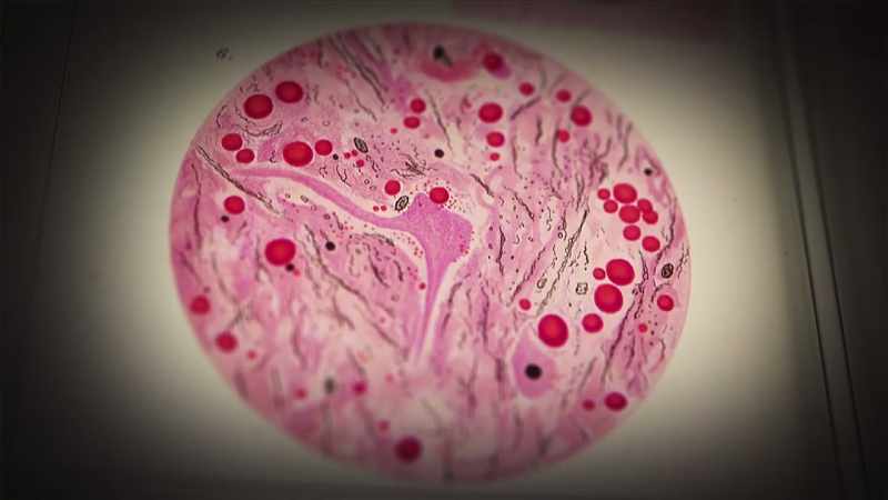 {\an1}NARRATOR: Soon, advances in imaging techniques