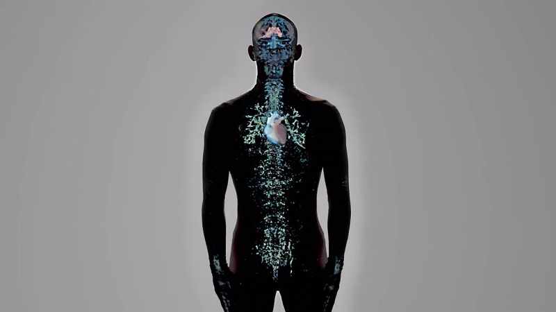 {\an1}-The exact cause is unknown