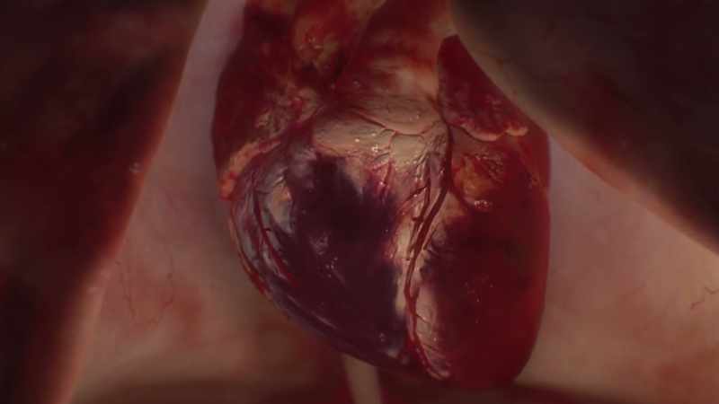{\an1}When they die, scar tissue grows in their place
