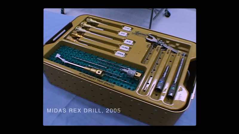 {\an8}But she described the tools they were using to saw through her skull