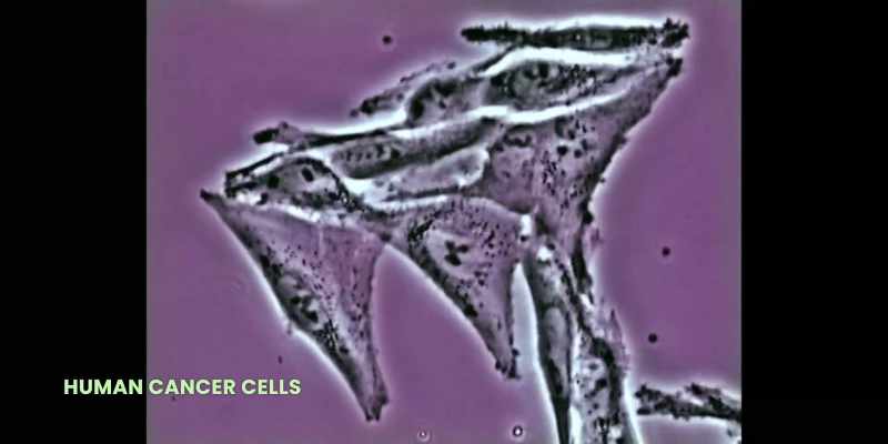 {\an8}CÉLULAS CANCERÍGENAS HUMANAS